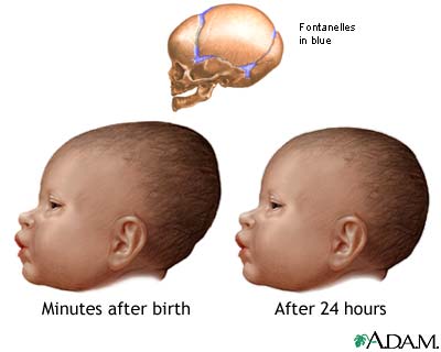 Newborn Molding.jpg